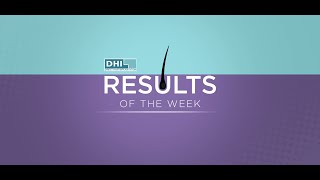 DHI Transplant | Results of the Week