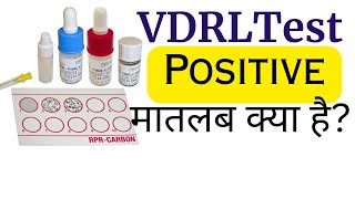 VDRL Test Hindi | VDRL test kya hota hai?