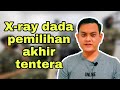 X-Ray dada pemilihan akhir || #DrRizalshare