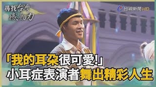 尋找台灣感動力-小耳症小精靈 擁抱不完美傳遞愛