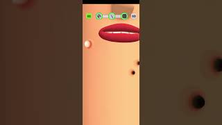 ASMR gameplays for you FuLL LvL 52 Let's play mobile games squeeze pimples #Shorts #androidgames