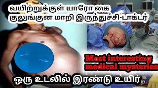 ஒரு உடம்பு 😨இரண்டு உயிர்/மருத்துவ உலகை உலுக்கிய சம்பவம்/சஞ்சு பகத்தின் உண்மை கதை