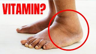 This vitamin removes swelling in the feet and legs🤯💥