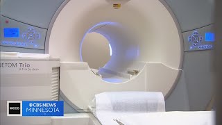 Minnesota researchers look to AI to detect cancer