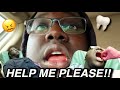 I GOT MY WISDOM TEETH REMOVED!! **Hilarious**