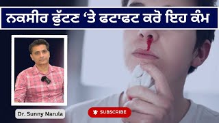 ਨਕਸੀਰ ਫੁੱਟਣ ‘ਤੇ ਫਟਾਫਟ ਕਰੋ ਇਹ ਕੰਮ | Nakseer | Dr Sunny Narula |