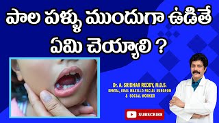 పాల పళ్ళు ముందుగా ఊడితే ఏమి చెయ్యాలి ? #drarumallasridharreddy #milkteeth #drsridhar