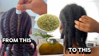 ROSEMARY OIL Transfomed My Hair Within 1 Week \u0026 4 Days 🤯| Massive Hair Growth Review| IT WORKED 😱