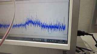 超音波システムの開発技術（メガヘルツの超音波発振制御実験）