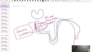 Davidson Renal Rest Part 1 ( Alport's syndrome up to Acute kidney Injury)