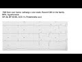 Prehospital Bradycardia Cases