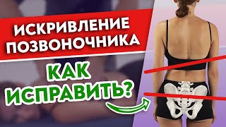 Как исправить искривление позвоночника и перекос таза?