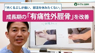 「内くるぶしが痛い、部活を休みたくない」成長期の有痛性外脛骨を改善