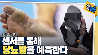 [핫클립] 당뇨발을 진단하는 디지털 치료제 / YTN 사이언스