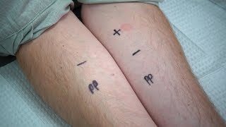 Penicillin Allergy: Evaluation and Testing