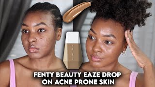 FENTY BEAUTY EAZE DROP BLURRED SKIN TINT ON ACNE PRONE \u0026 TEXTURED SKIN DEMO + REVIEW | KENSTHETIC