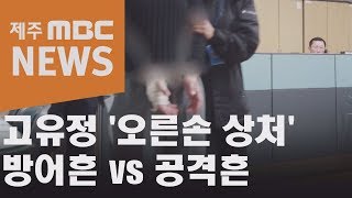 고유정 오른손 상처   방어흔 vs 공격흔