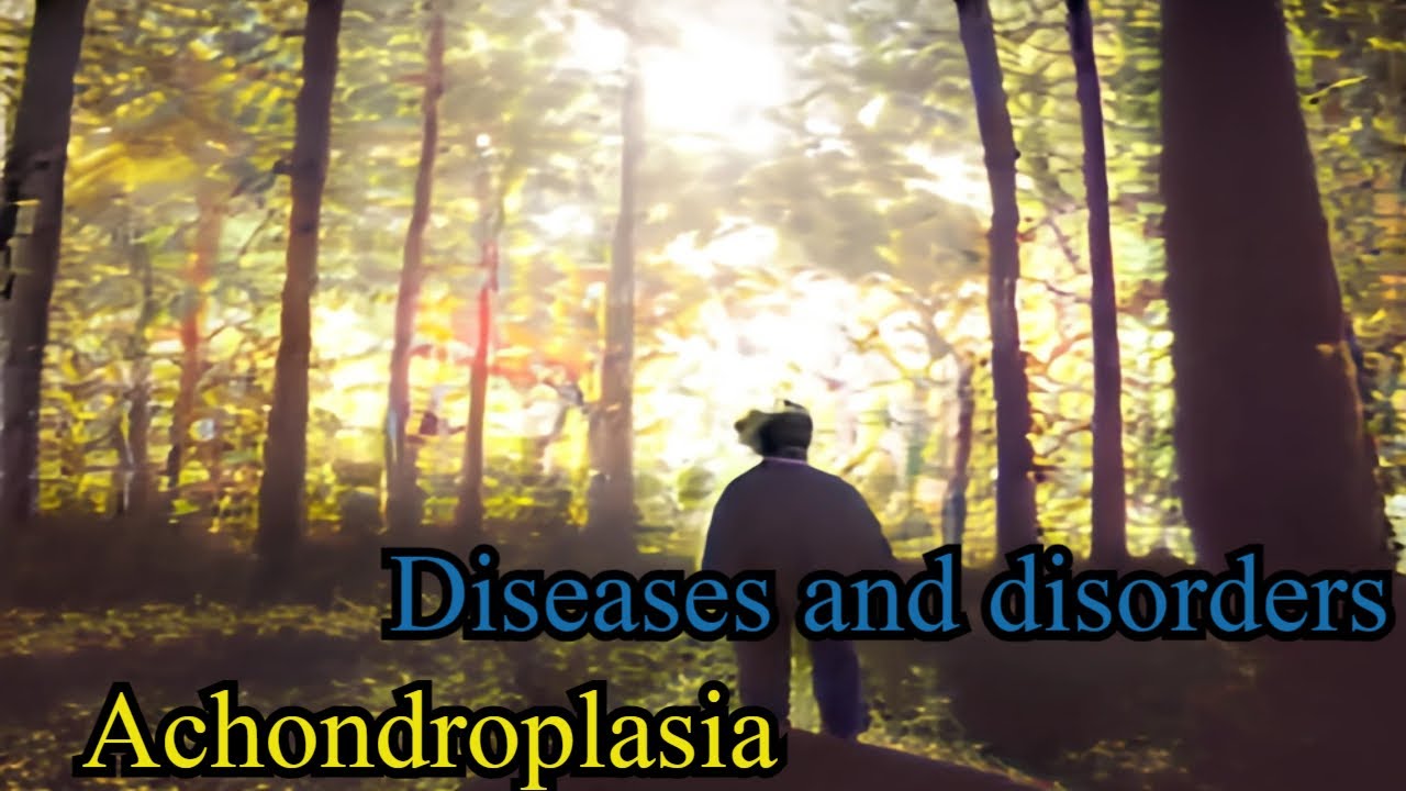 What Is Achondroplasia?. Treatment. - YouTube