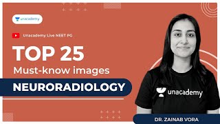 Top 25 must-know images | Neuroradiology | Dr. Zainab Vora