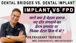 Bridge Or Implant : Which Is Best For You ? FPD vs Implant | Dr Prashant Tripathi | Endodontist