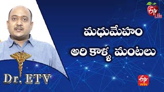 What Causes Inflammation Of The Legs?|మధుమేహం - అరి కాళ్ళ  మంటలు| Dr.ETV | 10th May 2022 | ETV Life