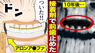 【実話】歯医者に行かず10年間瞬間接着剤で前歯を接着し続けるとどうなるのか？（マンガ動画）