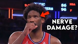 Joel Embiid Can’t Blink His Eye - Doctor Reacts