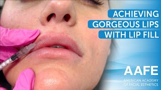 Achieving Gorgeous Lips with Lip Filler