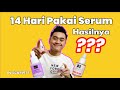 REVIEW SCARLETT ACNE SERUM ; 14 HARI PEMAKAIAN TERNYATA BEGINI