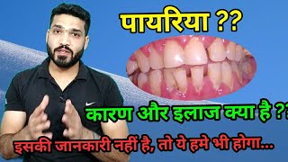 पायरिया क्या है ?? इसके कारण, लक्षण और इलाज । pyriya , periodontitis causes, symptoms \u0026 treatment