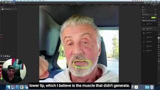 [Celebs] Celeb Plastic Surgery #NotByNayak - Stallone Edition