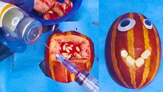 🍉❤️ ASMR Heart Surgery in a Melon! asmr doctor, #fruit #fruitsurgery #asmr 🩺🎧🔪