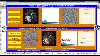Medical Image Encryption Using AES | AES Image Encryption Decryption Using Matlab Code