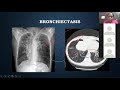 isa puducherry xray made easy approach to xrays in viva voce station