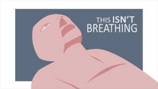 Agonal Breaths in Cardiac Arrest - Would you notice?