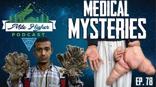 Unexplained Medical Mysteries - Podcast #78