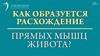 Что такое диастаз и как решить данную проблему? / #shorts /18+