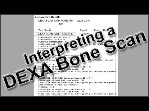 Interpreting a DEXA Bone Scan Interpreting a DEXA Bone Scan