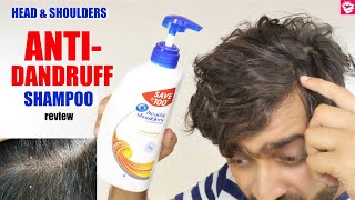 Head \u0026 Shoulders ANTI- DANDRUFF Shampoo review | Side Effects, Benefits, Effect | QualityMantra