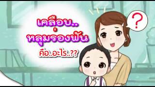 การเคลือบหลุมร่องฟัน/dent sealant