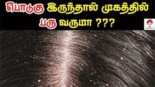 தலையில் பொடுகு இருந்தால், முகத்தில் பரு வருமா ? | Is dandruff causes pimples on face