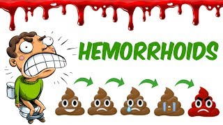 The Hemorrhoids!