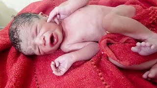 2.6kg little Handsome newborn baby boy immediately after birth #36weeks #cute #baby #firstcry #video