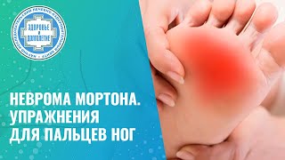 🦶  Неврома Мортона. Упражнение для баланса мышц стопы и голени.