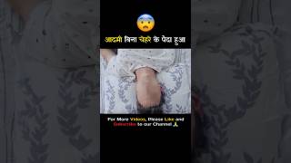 आदमी बिना चेहरे के पैदा हुआ..😨| Movie explained in Hindi #Short #ytshort #viral