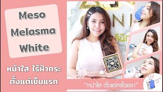 หน้าใส ไร้ฝ้ากระ ด้วย Meso Melasma White (ความรู้สึกดีๆหลังทำจากน้องเมย์)