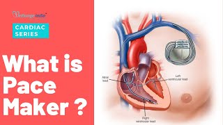 What is Pacemaker | Pacemaker in Heart