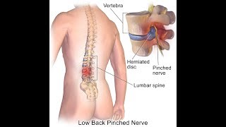 Best Chiropractor Neck Back Pain Adjustment Doctor 210-981-4434 San Antonio Texas 78109