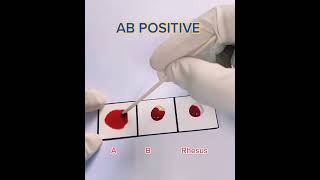 Blood group test /   #shorts
