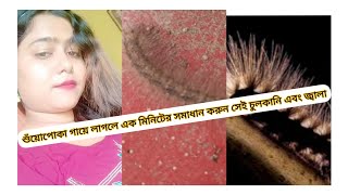 শুয়োপোকা গায়ে লেগে গেলে মাত্র 1 মিনিটে সমস্যার সমাধান করুন কোন চুলকানি এবং জালা ছাড়াই